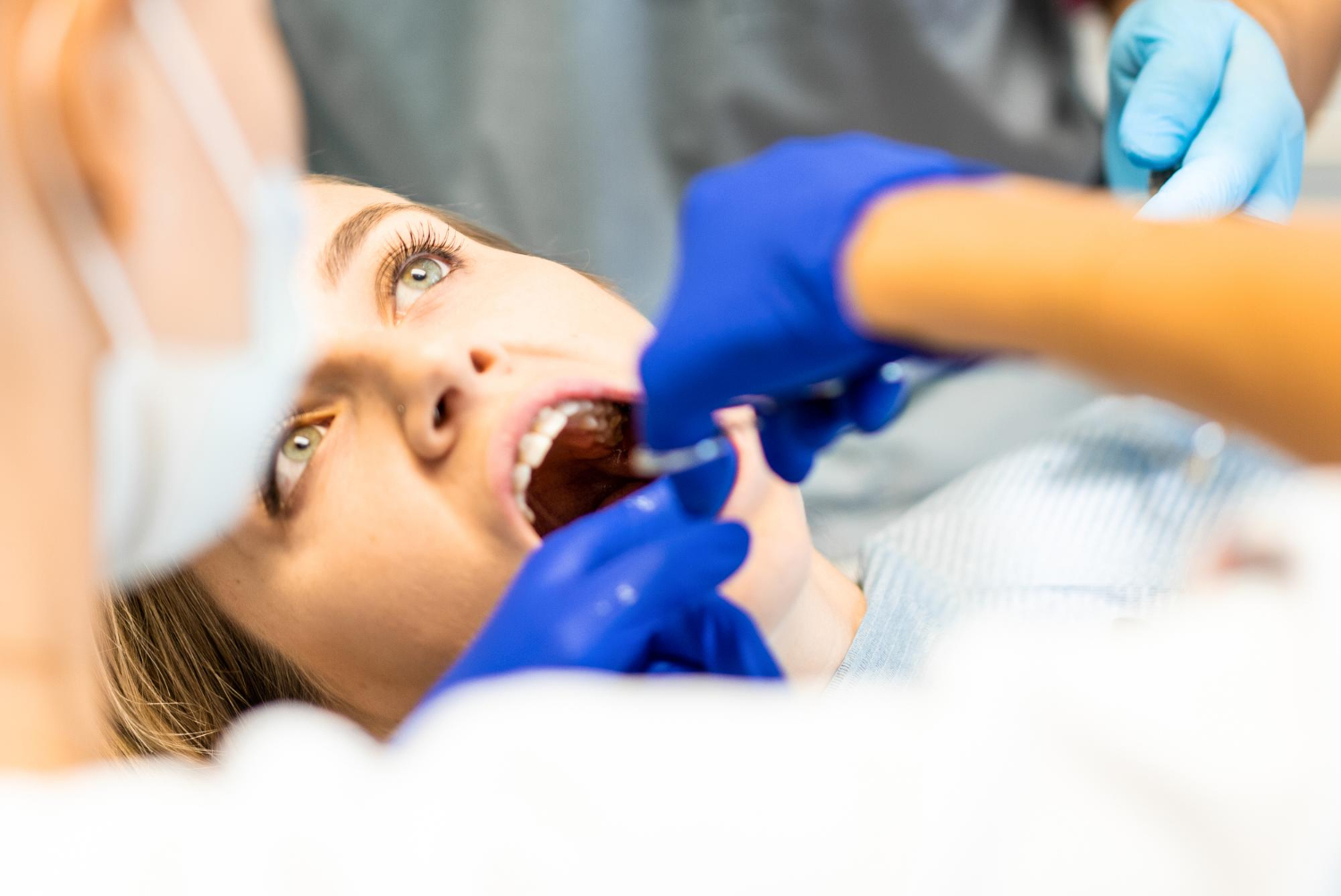 About Tooth Extractions
